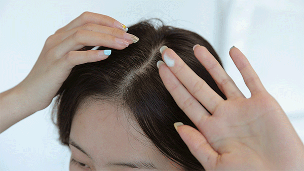 多亏它帮我守住了发际线凯发k8入口线年才敢说(图20)