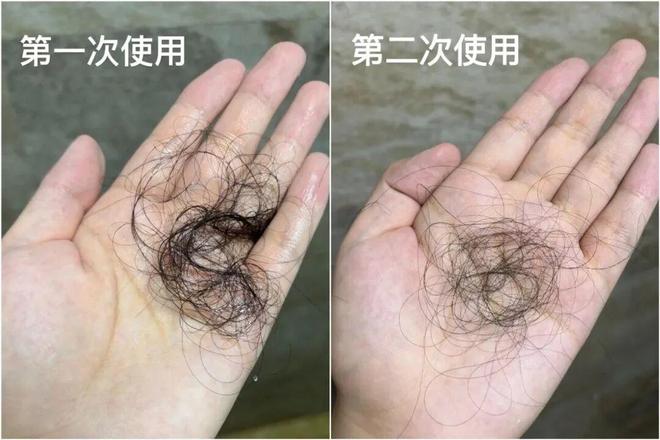 多亏它帮我守住了发际线凯发k8入口线年才敢说(图38)