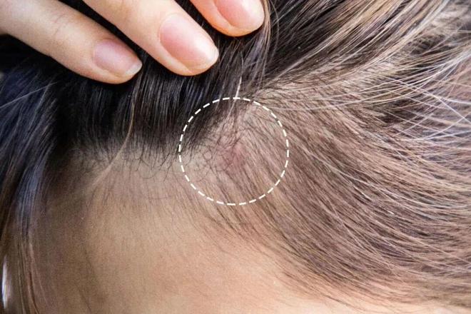 多亏它帮我守住了发际线凯发k8入口线年才敢说(图40)